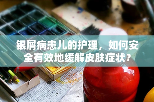 银屑病患儿的护理，如何安全有效地缓解皮肤症状？